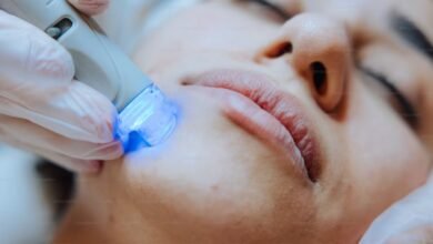 5 Ways Laser Treatment Is The Best Solution For Your Skin's Hyperpigmentation 