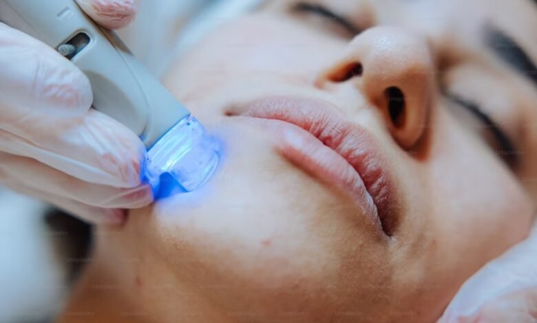 5 Ways Laser Treatment Is The Best Solution For Your Skin's Hyperpigmentation