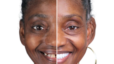 How Dental Implants Help Preserve What Natural Teeth Cannot